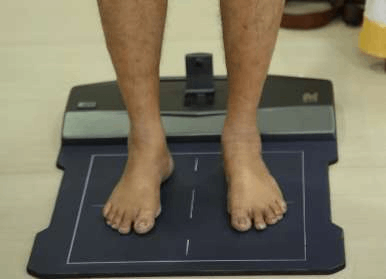 Computerized Gait & Foot Scan