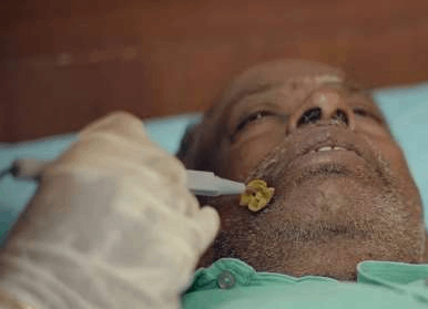 Electrical Muscular Stimulation Treatment
